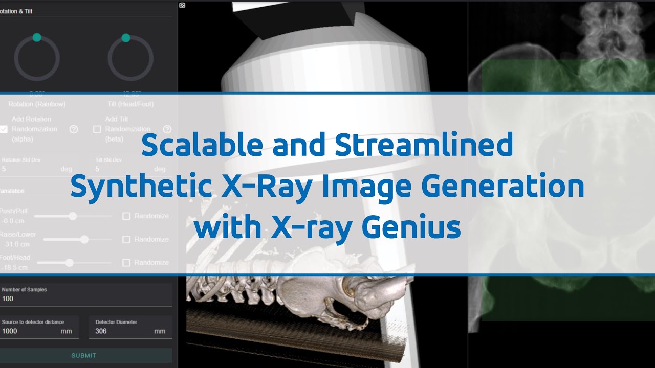 X-ray Genius Webinar
