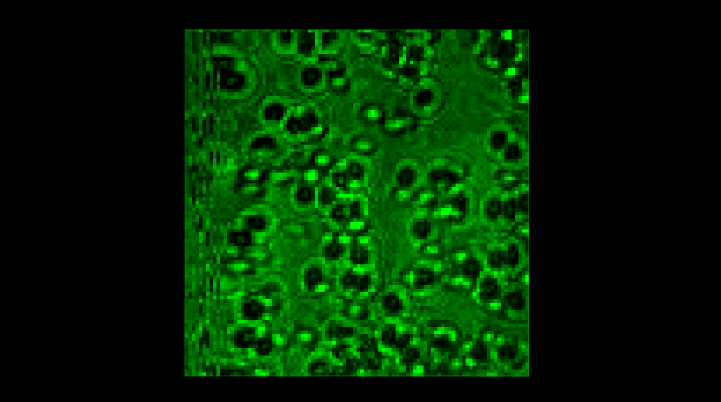 DIY Laser Scann of Yeast Cells