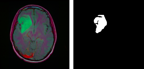 Brain and its segmentation mask