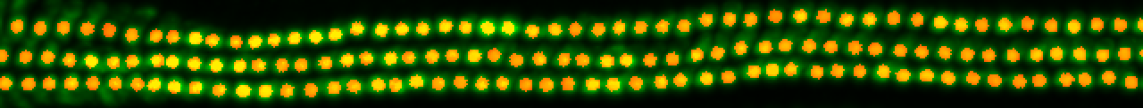 overlay-of-thestraigthened-cells-and-spots-iamges.png