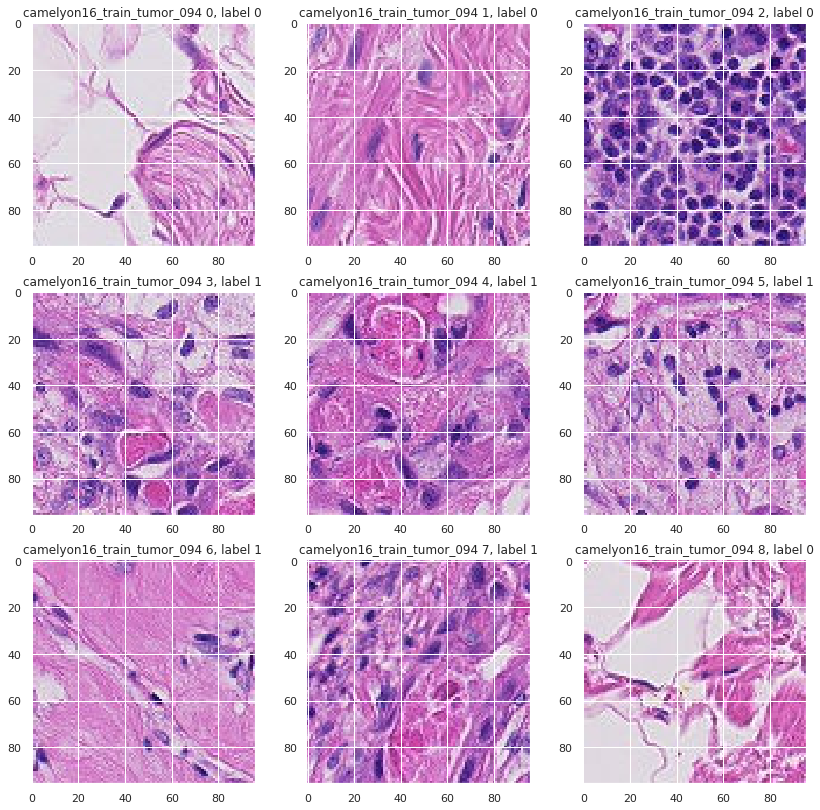 Histopathologic Cancer Detection