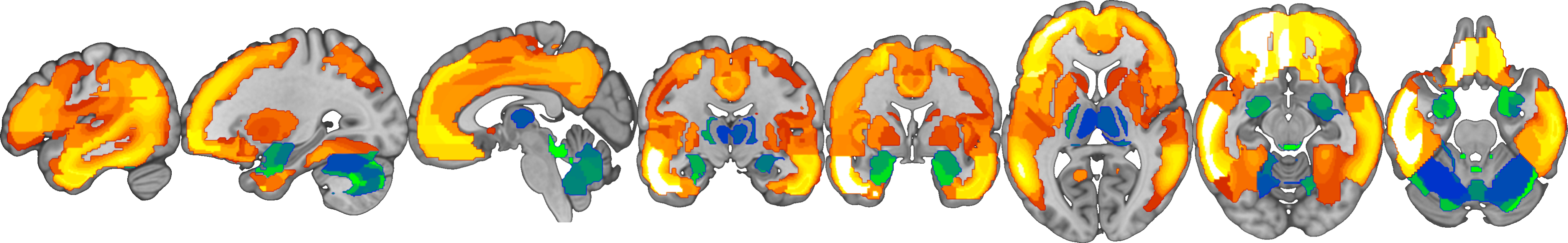 age_effects