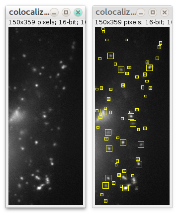 before and after detection