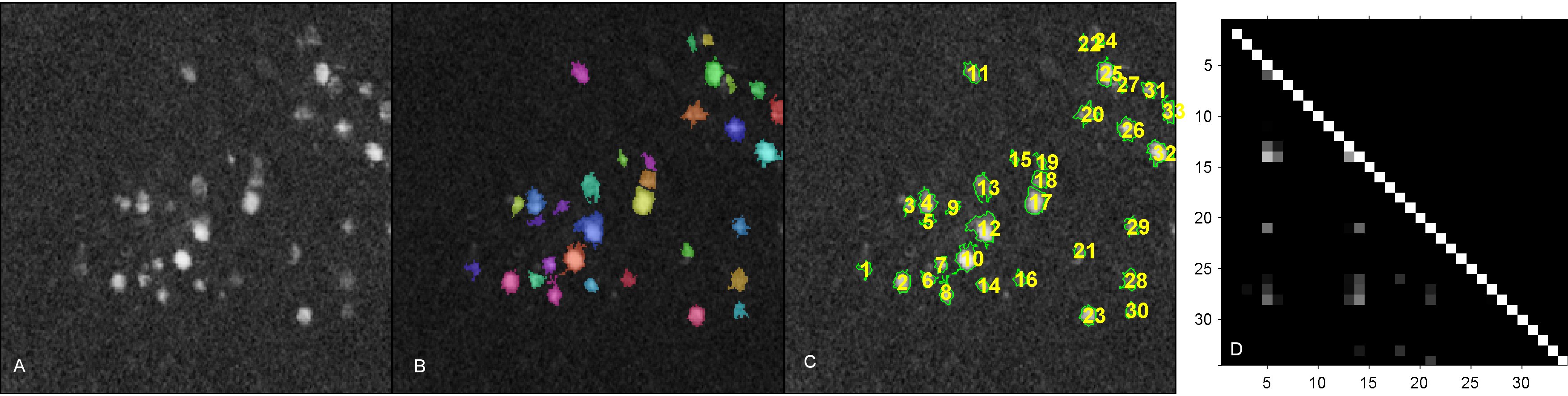 MATLAB Calcium Signal Extract ROI image