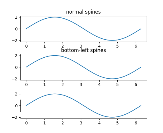 Spines explanation image