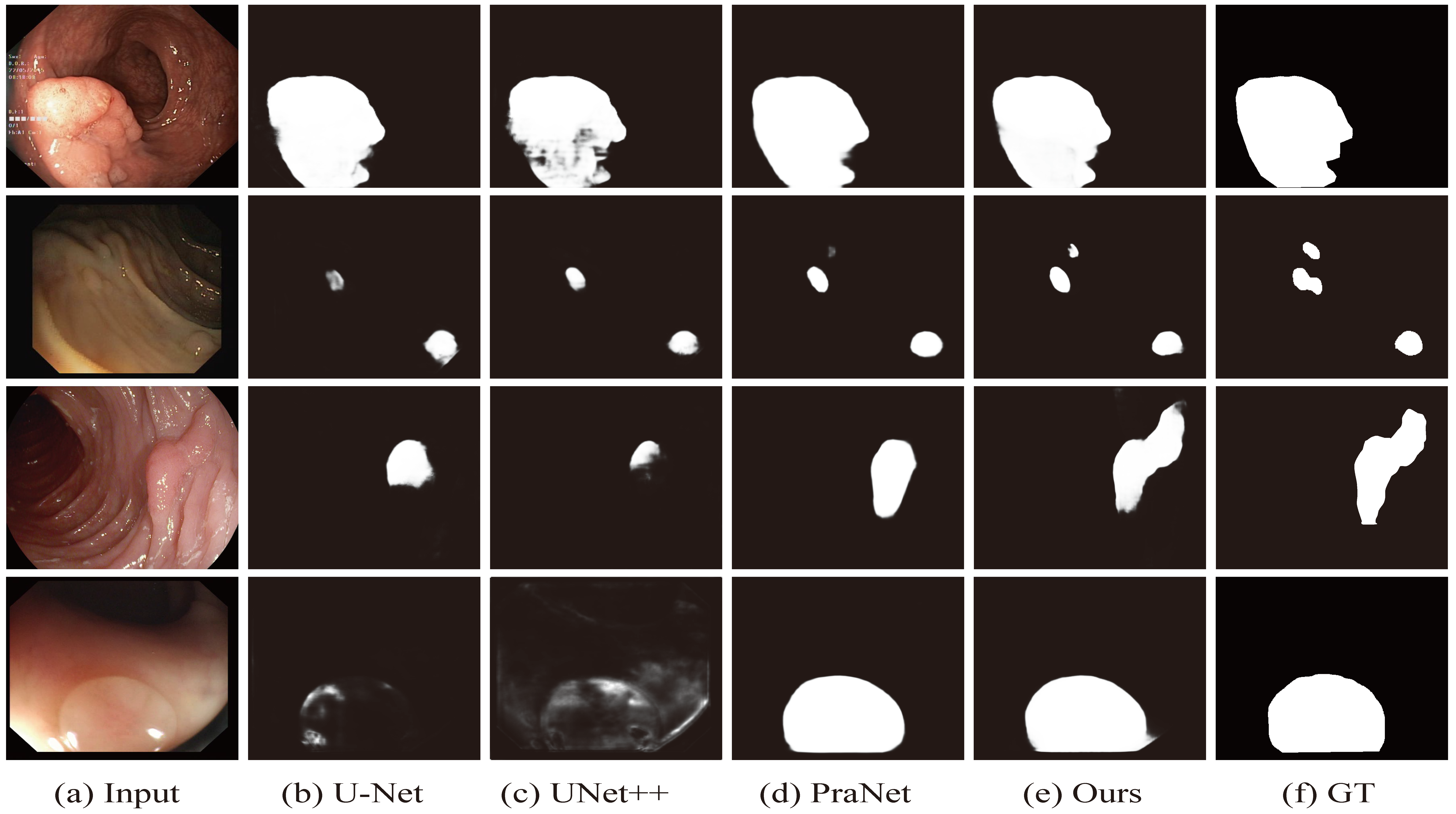 display-polyp