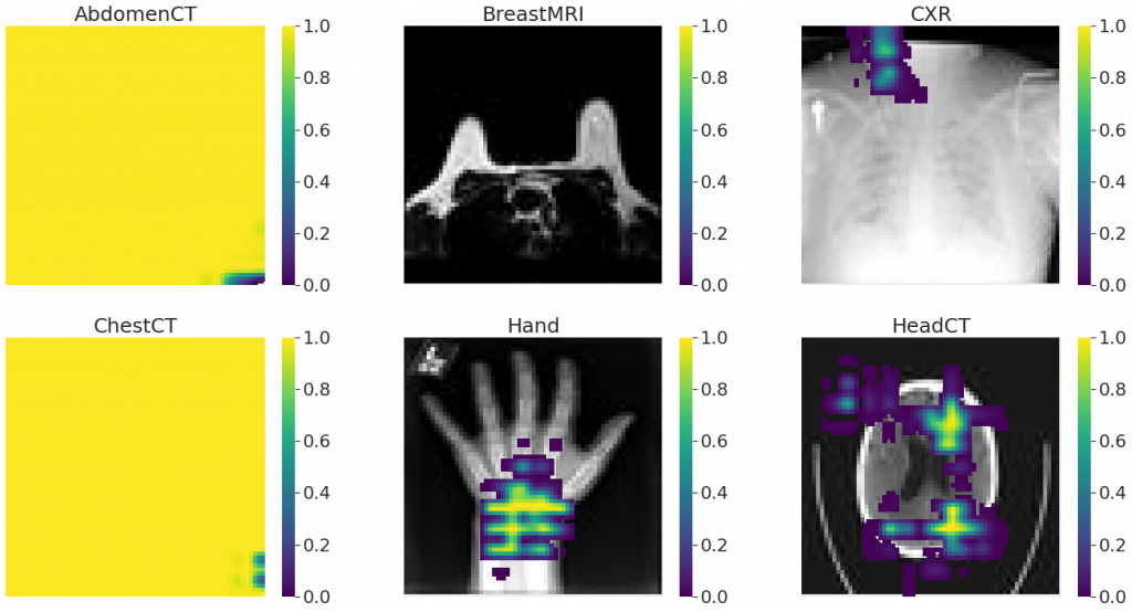 best model occlusion sensitivity for each class example