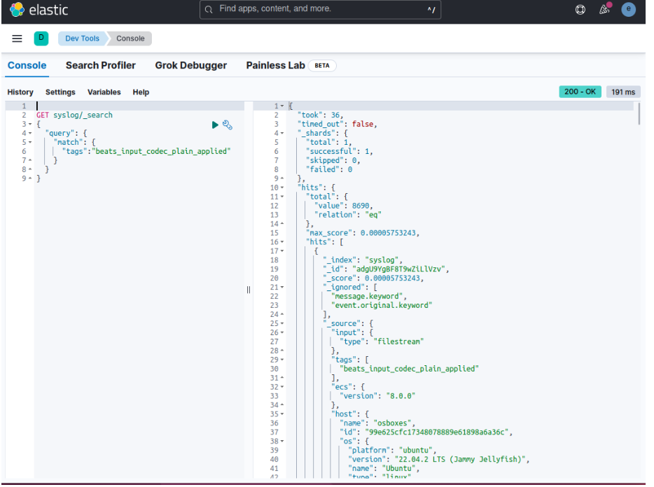 Kibana Console