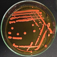 Red colonies of the yeast Rhodotorula mucilaginosa growing on Petri dish of Sabouraud agar