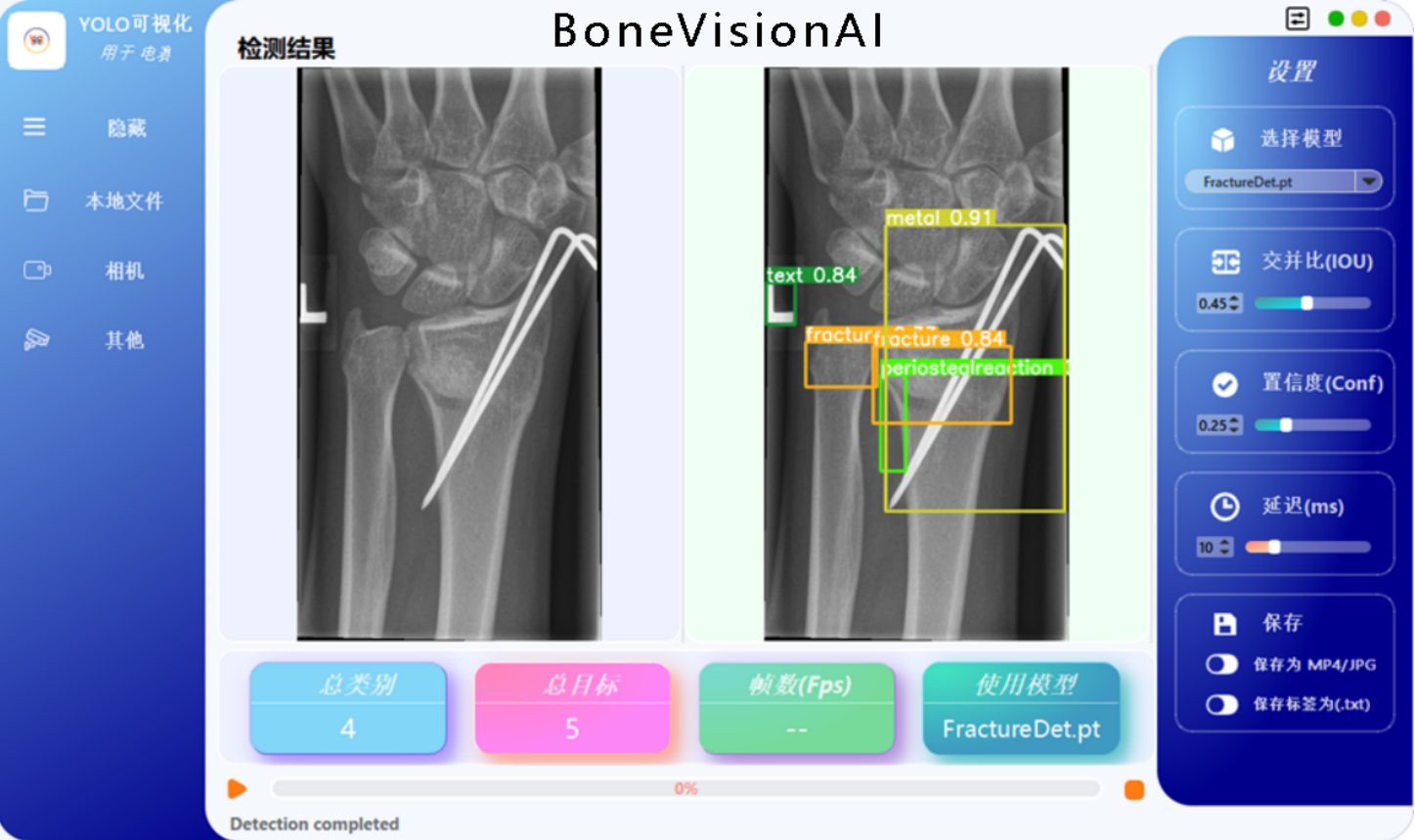 BoneVisionAl