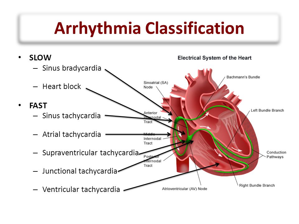 Github Hodades Ecg Based Arrhythmia Classification Using Deep