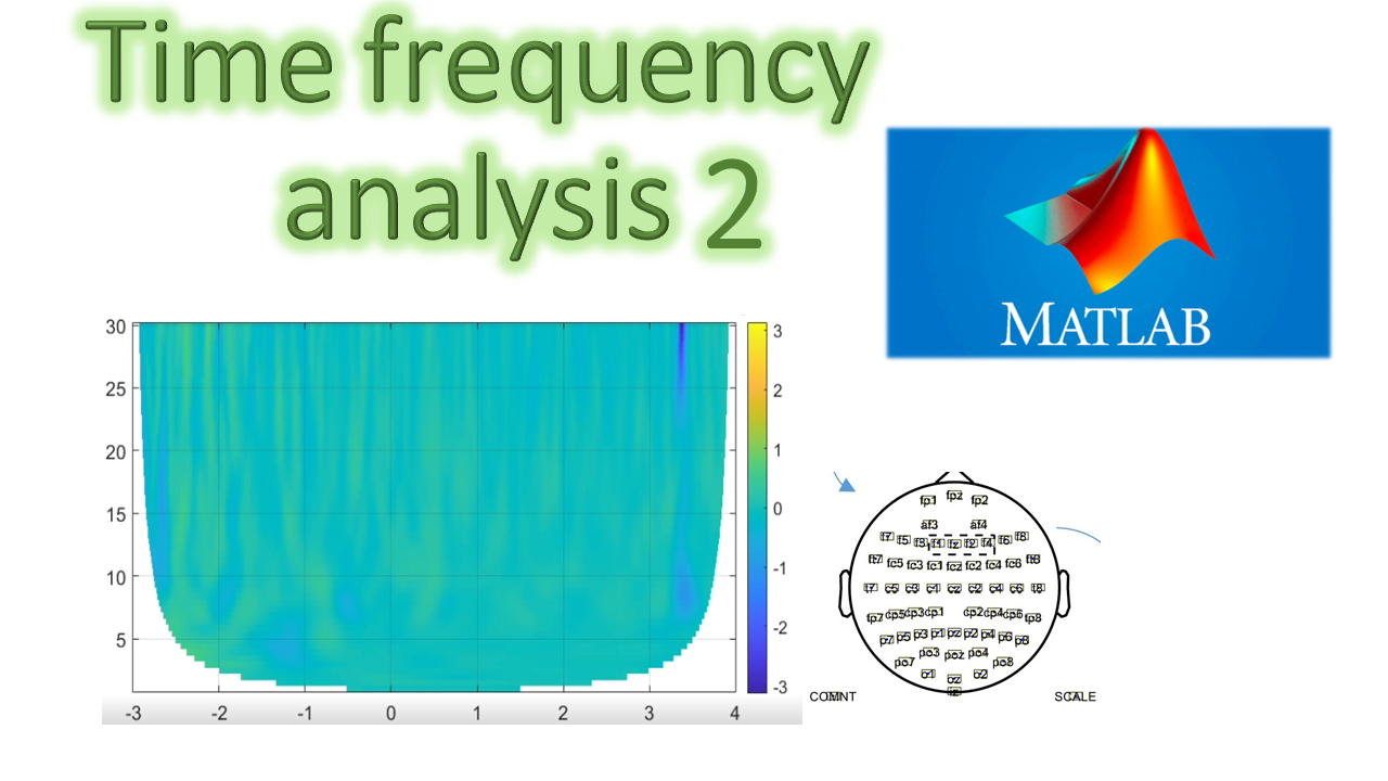 Time Frequency analysis of EEG signals (part 2)