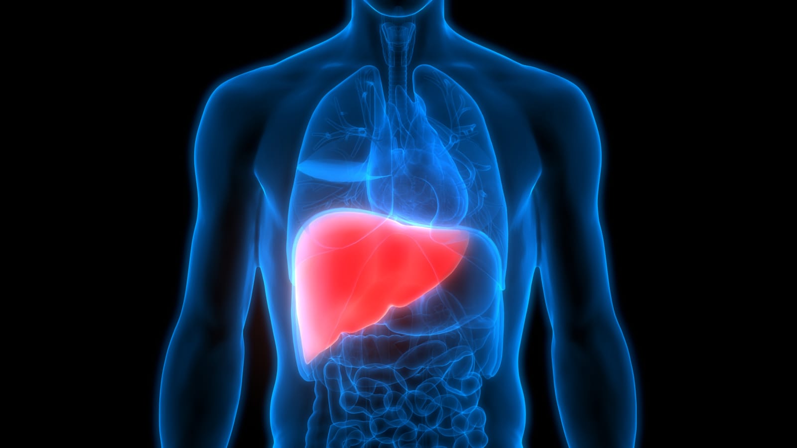 Liver Cirrhosis