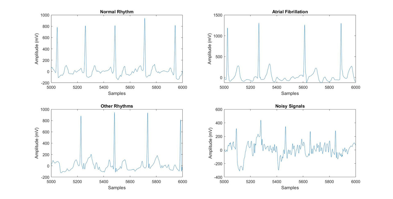 Signal-types