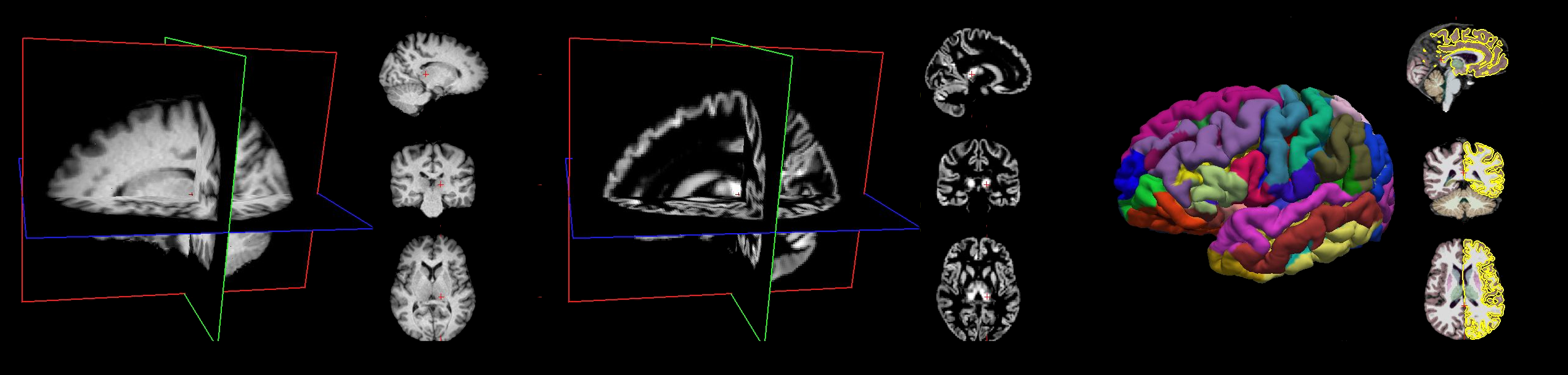 BrainPrep preprocessings