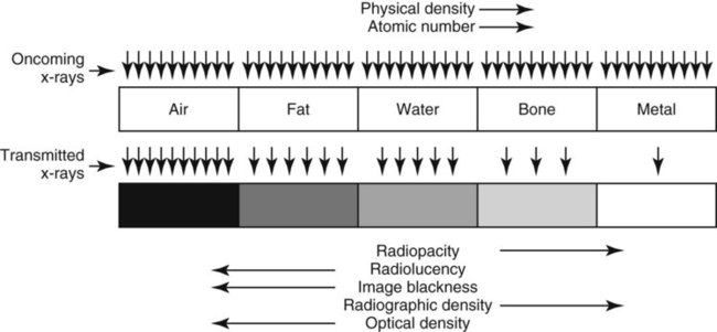 the five main daiodensities ona standard radiograph