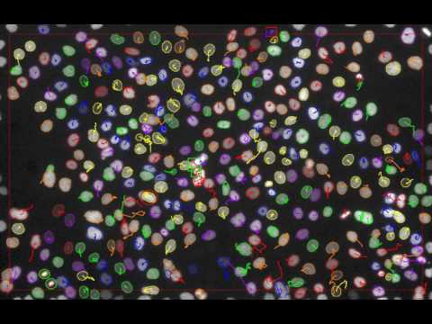 CPN Tracking Video Playlist