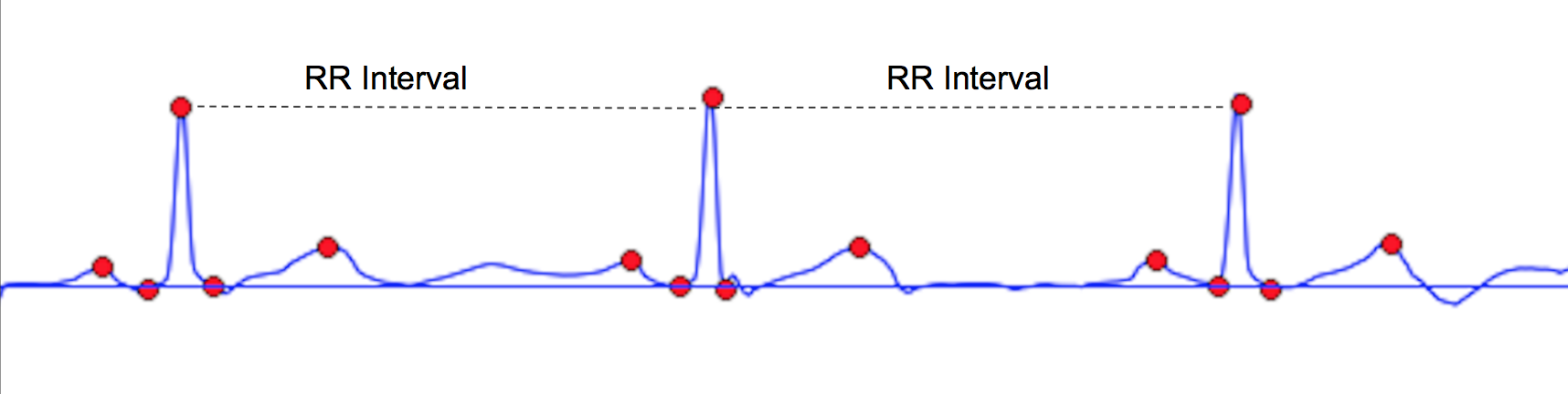 Signal_W/_Features